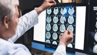 recent-legal-trends-for-brain-injury-cases-in-california