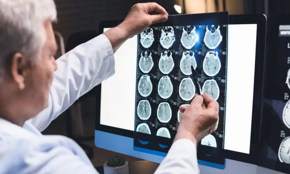 recent-legal-trends-for-brain-injury-cases-in-california